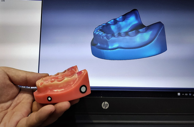 3D-Scannen f&uuml;r das Design von intraoralem Zahnersatz
